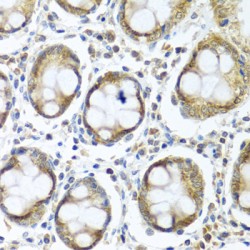 Interferon Induced Protein 44 (IFI44) Antibody