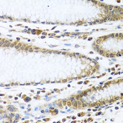 Interferon Induced Protein 44 (IFI44) Antibody