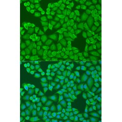Interferon Induced Protein 44 (IFI44) Antibody