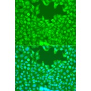 Immunofluorescence analysis of U2OS cells using TAZ Antibody (1/100 dilution). Blue: DAPI for nuclear staining.