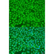 Immunofluorescence analysis of U2OS cells using PNKD Antibody (1/100 dilution). Blue: DAPI for nuclear staining.