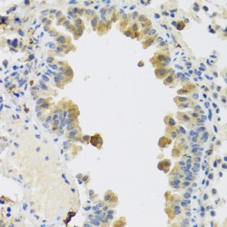 R-Spondin 1 (RSPO1) Antibody
