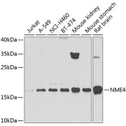 Western blot analysis of extracts of various cell lines using NME4 Antibody (1/1000 dilution).
