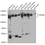 Western blot analysis of extracts of various cell lines using PITRM1 Antibody (1/1000 dilution).