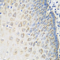 Methionine-R-Sulfoxide Reductase B2, Mitochondrial (MSRB2) Antibody
