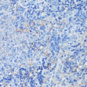 Immunohistochemistry of paraffin-embedded Rat spleen using CR2 Antibody (1/100 dilution, 40x lens).