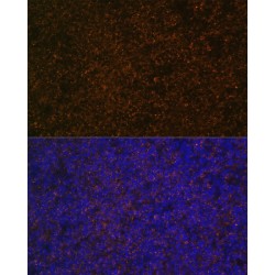 Complement Receptor 2 / CD21 (CR2) Antibody