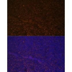 Complement Receptor 2 / CD21 (CR2) Antibody