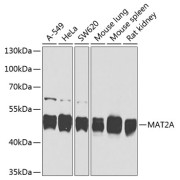 Western blot analysis of extracts of various cell lines using MAT2A Antibody (1/1000 dilution).