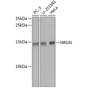 Western blot analysis of extracts of various cell lines using NRGN Antibody (1/1000 dilution).