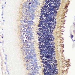 Phosducin (PDC) Antibody