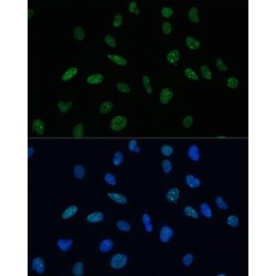 Myocardin-Related Transcription Factor A (MRTFA) Antibody