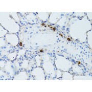 Immunohistochemistry of paraffin-embedded Rat lung using TEFM Antibody (1/100 dilution, 40x lens).