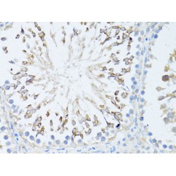 Transcription Elongation Factor, Mitochondrial (TEFM) Antibody