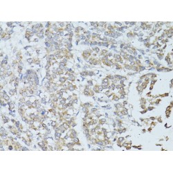 Transcription Elongation Factor, Mitochondrial (TEFM) Antibody