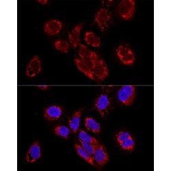 Transcription Elongation Factor, Mitochondrial (TEFM) Antibody