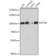 Western blot analysis of extracts of various cell lines using B-Raf Antibody (1/1000 dilution).