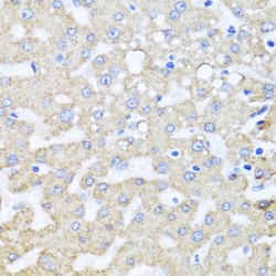 ADP-Ribosylation Factor-Like Protein 6 (ARL6) Antibody