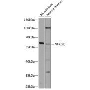 Western blot analysis of extracts of various cell lines using NFKBIE Antibody (1/1000 dilution).