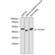 Western blot analysis of extracts of various cell lines using KCNJ4 Antibody (1/1000 dilution).