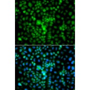 Immunofluorescence analysis of A549 cells using CIDEA Antibody