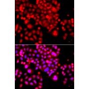 Immunofluorescence analysis of A549 cells using ASCC3 Antibody