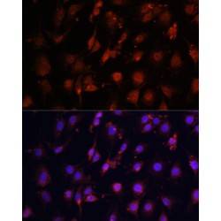 Methylcytosine Dioxygenase TET3 (TET3) Antibody