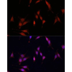 Methylcytosine Dioxygenase TET3 (TET3) Antibody
