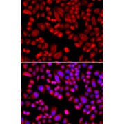Immunofluorescence analysis of A549 cells using ARPC3 Antibody