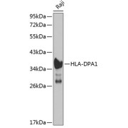 Western blot analysis of extracts of Raji cells using HLA-DPA1 Antibody (1/1000 dilution).