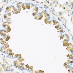 S100 Calcium Binding Protein A7 (S100A7) Antibody