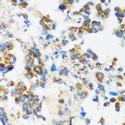 Apolipoprotein B mRNA Editing Enzyme Catalytic Subunit 3F (APOBEC3F) Antibody