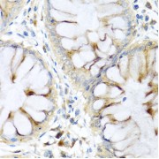 Immunohistochemistry of paraffin-embedded Human colon using PI3 Antibody (1/100 dilution, 40x lens).