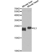 abx006305