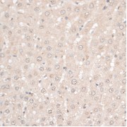 Immunohistochemistry of paraffin-embedded Rat liver using HMGN1 Antibody (1/100 dilution, 40x lens).