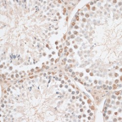 Non-Histone Chromosomal Protein HMG-14 (HMGN1) Antibody