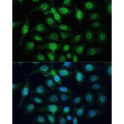 ZW10 Interactor (ZWINT) Antibody