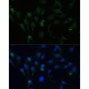 Immunofluorescence analysis of C6 cells using ZWINT Antibody (1/100 dilution, 40x lens). Blue: DAPI for nuclear staining.