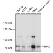 Western blot analysis of extracts of various cell lines using BMX Antibody (1/1000 dilution).