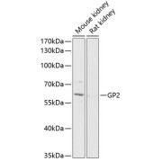 Western blot analysis of extracts of various cell lines using GP2 Antibody (1/1000 dilution).