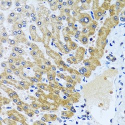 Carboxypeptidase A6 (CPA6) Antibody