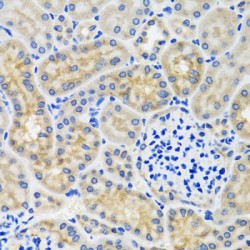 Anthrax Toxin Receptor 2 (ANTXR2) Antibody