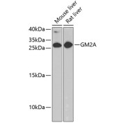 Western blot analysis of extracts of various cell lines using GM2A Antibody (1/1000 dilution).