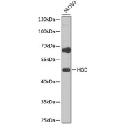 Western blot analysis of extracts of SKOV3 cells using HGD Antibody (1/1000 dilution).