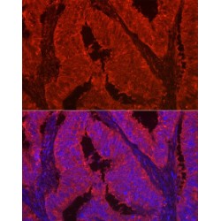 Galectin 2 (LGALS2) Antibody