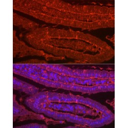 Galectin 2 (LGALS2) Antibody