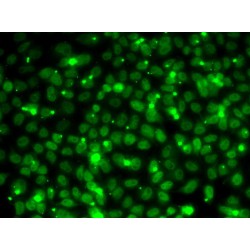 Replication Protein A 14 kDa Subunit (RPA3) Antibody