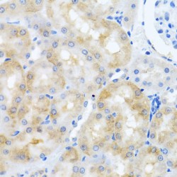 SCO1, Cytochrome C Oxidase Assembly Protein (SCO1) Antibody