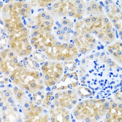 SCO1, Cytochrome C Oxidase Assembly Protein (SCO1) Antibody