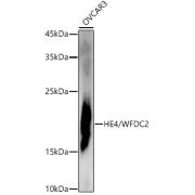Western blot analysis of extracts of OVCAR3 cells using HE4/WFDC2 Antibody (1/1000 dilution).